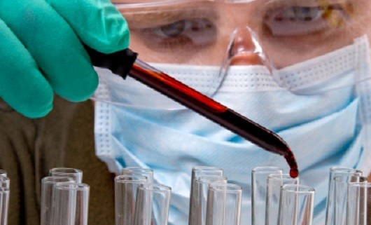 Blutprobe im Labor